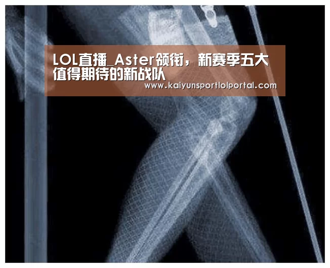 LOL直播